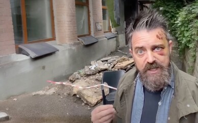 В Киеве на Подоле на американского режиссера упал балкон