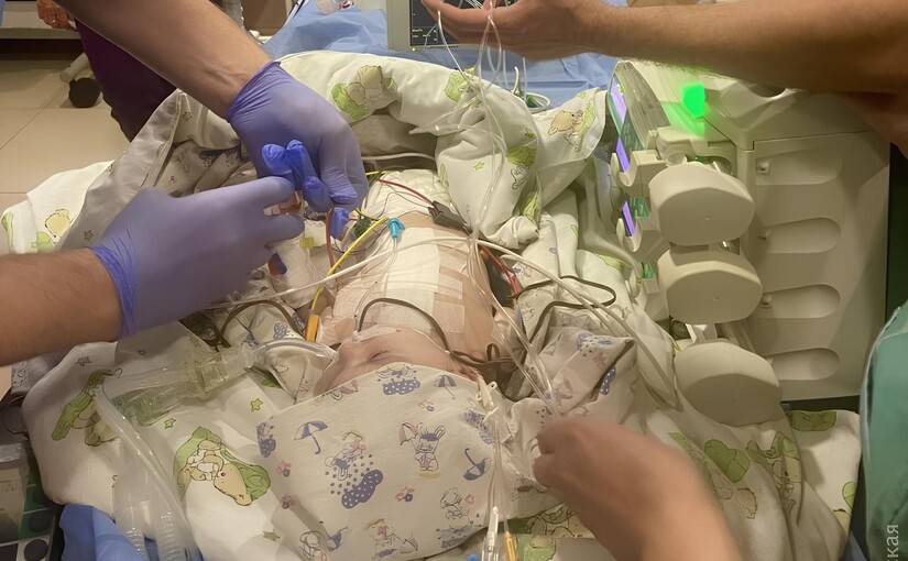 Одеські кардіохірурги провели унікальну операцію немовляті з вродженою вадою серця - фото